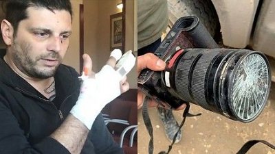 榴彈碎片擊中戰地攝影師，Leica 相機又救一命